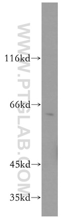 AKT1 Antibody in Western Blot (WB)