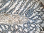 MEK1 Antibody in Immunohistochemistry (Paraffin) (IHC (P))