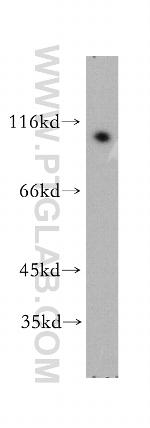 NFKB2 Antibody in Western Blot (WB)