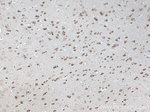 ADORA2A Antibody in Immunohistochemistry (Paraffin) (IHC (P))