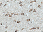 ADORA2A Antibody in Immunohistochemistry (Paraffin) (IHC (P))