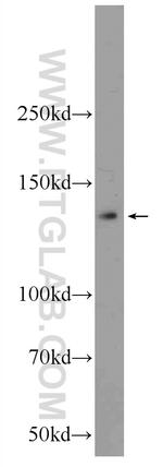 KIAA1033 Antibody in Western Blot (WB)