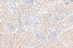 Angptl4 Antibody in Immunohistochemistry (Paraffin) (IHC (P))