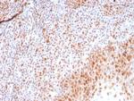 PCNA (Proliferating Cell Nuclear Antigen) (G1- and S-phase Marker) Antibody in Immunohistochemistry (Paraffin) (IHC (P))