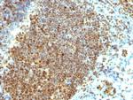 PCNA (Proliferating Cell Nuclear Antigen) Antibody in Immunohistochemistry (Paraffin) (IHC (P))