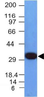 PCNA (Proliferating Cell Nuclear Antigen) Antibody in Western Blot (WB)