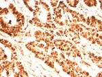 PCNA (Proliferating Cell Nuclear Antigen) (G1- and S-phase Marker) Antibody in Immunohistochemistry (Paraffin) (IHC (P))