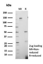 PCNA (Proliferating Cell Nuclear Antigen) (G1- and S-phase Marker) Antibody in SDS-PAGE (SDS-PAGE)