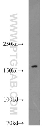 SRC 1 Antibody in Western Blot (WB)