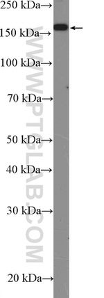SRC 1 Antibody in Western Blot (WB)