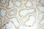 SRC 1 Antibody in Immunohistochemistry (Paraffin) (IHC (P))