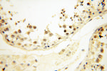 SRC 1 Antibody in Immunohistochemistry (Paraffin) (IHC (P))