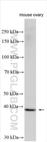 p38 MAPK Antibody in Western Blot (WB)