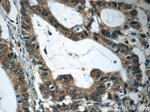 RAF1 Antibody in Immunohistochemistry (Paraffin) (IHC (P))