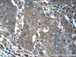 RAF1 Antibody in Immunohistochemistry (Paraffin) (IHC (P))