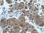 PPP1R13L Antibody in Immunohistochemistry (Paraffin) (IHC (P))