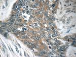 TMPRSS3 Antibody in Immunohistochemistry (Paraffin) (IHC (P))