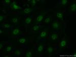JNK Antibody in Immunocytochemistry (ICC/IF)