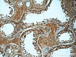 ATP6V1A Antibody in Immunohistochemistry (Paraffin) (IHC (P))