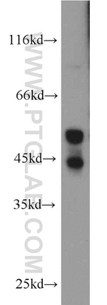JNK2 Antibody in Western Blot (WB)