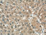 Cyp4a12a Antibody in Immunohistochemistry (Paraffin) (IHC (P))