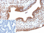 EGFL7 (Tumor Angiogenesis Marker) Monoclonal Antibody (EGFL7/9497)