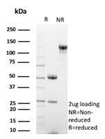 EGFL7 (Tumor Angiogenesis Marker) Antibody in SDS-PAGE (SDS-PAGE)