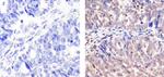 Cullin 2 Polyclonal Antibody