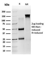 ZNF639/ZASC1 (Transcription Factor) Antibody in SDS-PAGE (SDS-PAGE)
