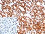 Claudin 18.2 Recombinant Rabbit Monoclonal Antibody (CLDN18.2/8141R)