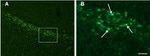 beta Amyloid Antibody in Immunohistochemistry (IHC)