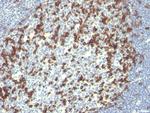 PDCD1/PD1/CD279 (Programmed Cell Death 1) Antibody in Immunohistochemistry (Paraffin) (IHC (P))