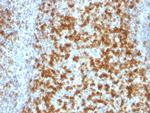 PDCD1/PD1/CD279 (Programmed Cell Death 1) Antibody in Immunohistochemistry (Paraffin) (IHC (P))