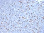 PDCD1/PD1/CD279 (Programmed Cell Death 1) Antibody in Immunohistochemistry (Paraffin) (IHC (P))