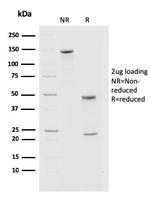 PDCD1/PD1/CD279 (Programmed Cell Death 1) Antibody in SDS-PAGE (SDS-PAGE)