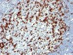 PDCD1/PD1/CD279 (Programmed Cell Death 1) Antibody in Immunohistochemistry (Paraffin) (IHC (P))