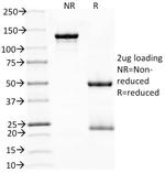 PDCD1/PD1/CD279 (Programmed Cell Death 1) Antibody in SDS-PAGE (SDS-PAGE)
