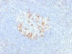 PDCD1/PD1/CD279 (Programmed Cell Death 1) Recombinant Rabbit Monoclonal Antibody (PDCD1/7276R)