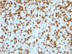 PDCD1/PD1/CD279 (Programmed Cell Death 1) Antibody in Immunohistochemistry (Paraffin) (IHC (P))