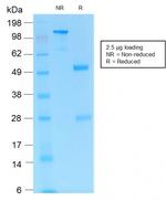 PDCD1/PD1/CD279 (Programmed Cell Death 1) Antibody in SDS-PAGE (SDS-PAGE)