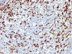 PDCD1/PD1/CD279 (Programmed Cell Death 1) Antibody in Immunohistochemistry (Paraffin) (IHC (P))