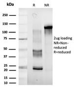 DDX41 Antibody in SDS-PAGE (SDS-PAGE)