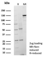 CD203c/ENPP3 (Basophil Marker) Antibody in SDS-PAGE (SDS-PAGE)