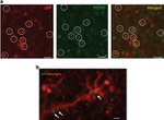 PSD-95 Antibody in Immunohistochemistry (IHC)