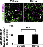 PSD-95 Antibody in Immunohistochemistry (IHC)