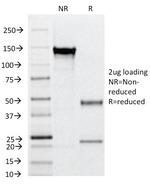 CD31/PECAM-1 (Endothelial Cell Marker) Antibody in SDS-PAGE (SDS-PAGE)