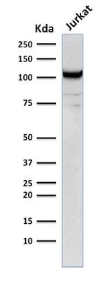 CD31/PECAM-1 (Endothelial Cell Marker) Antibody in Western Blot (WB)
