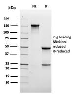 CD31/PECAM-1 (Endothelial Cell Marker) Antibody in SDS-PAGE (SDS-PAGE)
