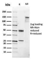 CD31/PECAM-1 (Endothelial Cell Marker) Antibody in SDS-PAGE (SDS-PAGE)