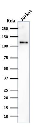 CD31/PECAM-1 (Endothelial Cell Marker) Antibody in Western Blot (WB)